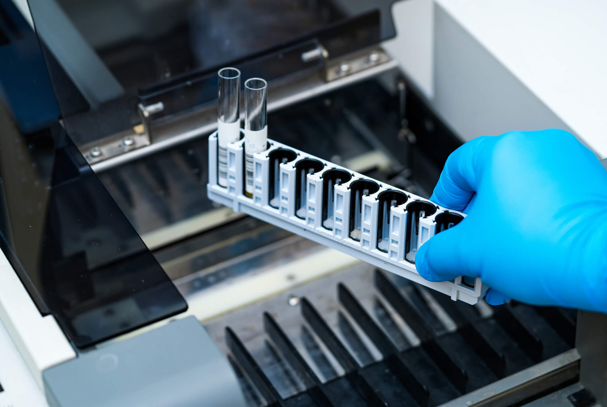 Hand holding a carrier with vials